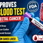 FDA Approves New Blood Test That Could Expand Early Colorectal Cancer Screening